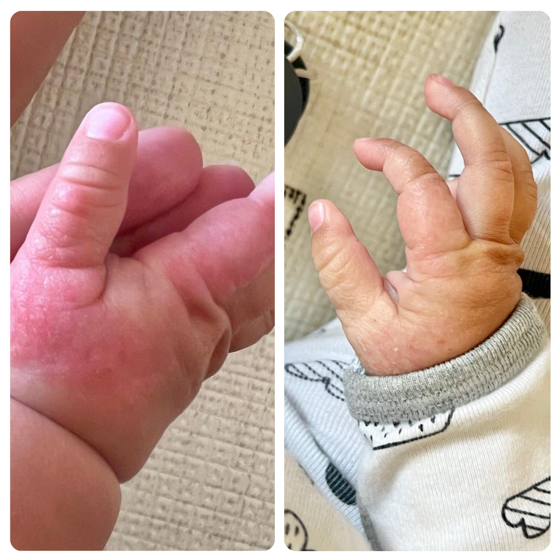 Repair Balm (Standard Potency)