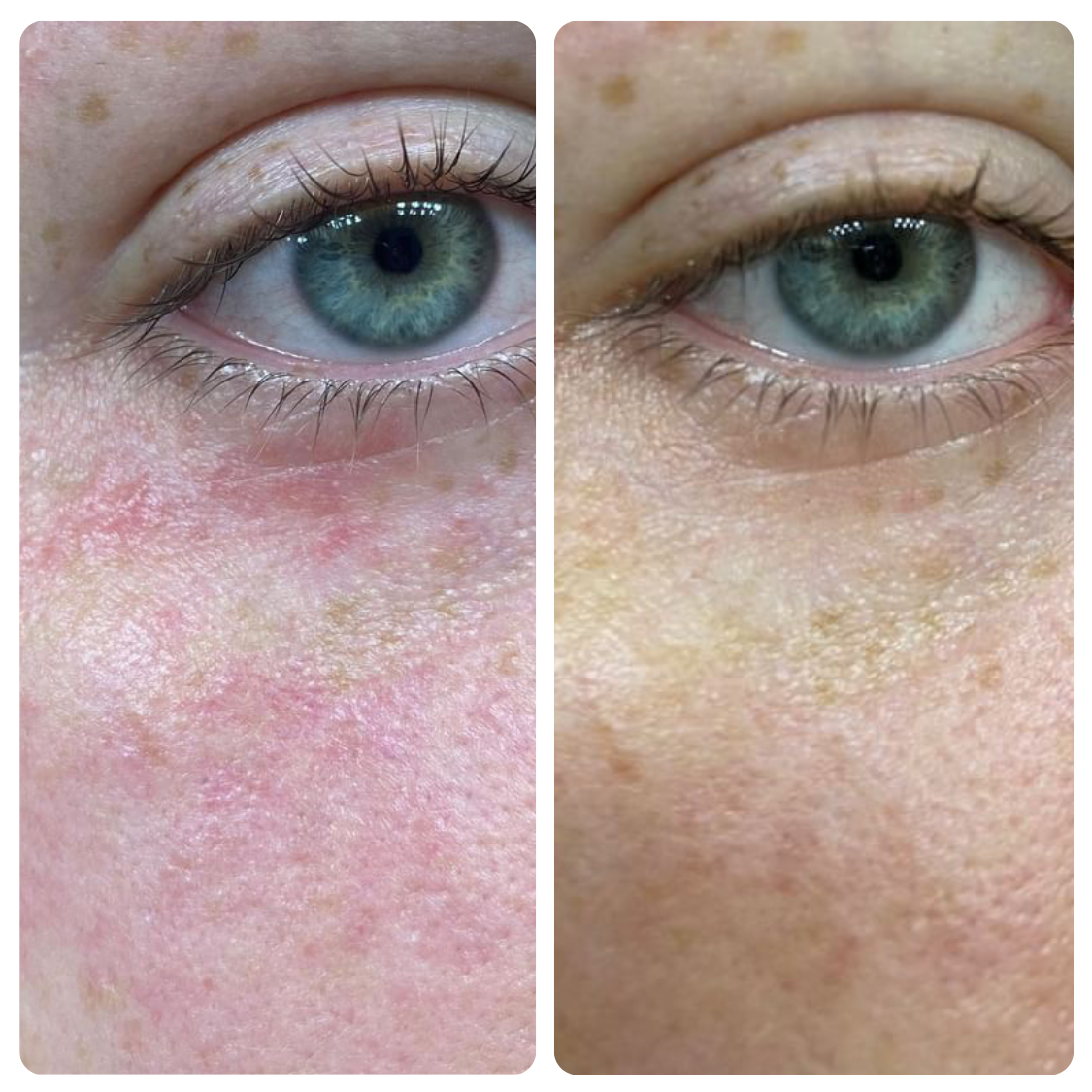 Repair Serum (Regular Potency)